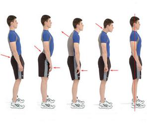 Как выровнять осанку?